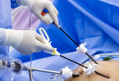 Laparoscopy Surgery: Types, Procedure, Recovery, Stitches & Success Rate in India